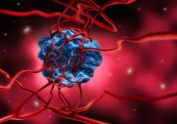 Tumour Genomic Heterogeneity in Immunotherapy