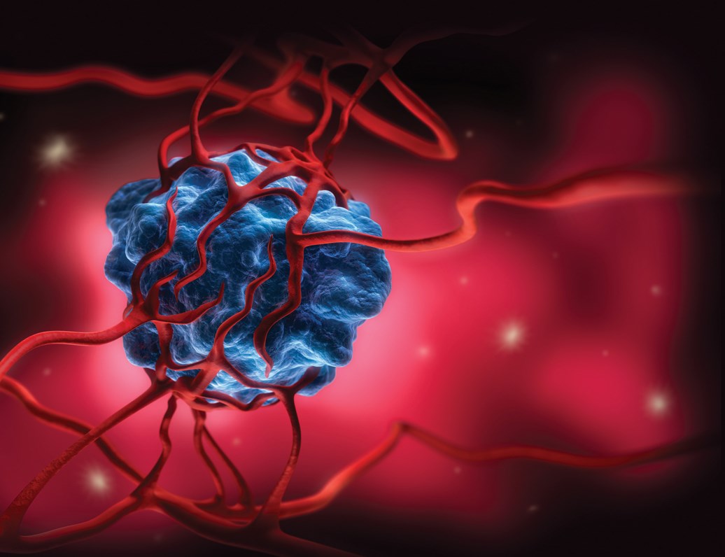 Tumour Genomic Heterogeneity in Immunotherapies